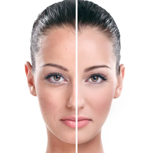 Brightening & Even Tone