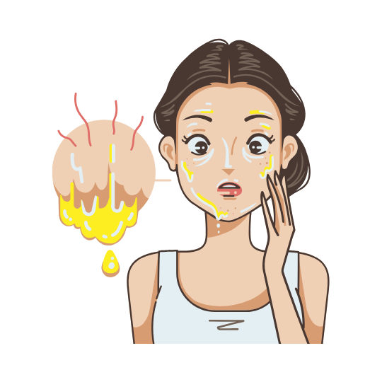 Oily & Acne Prone Skin